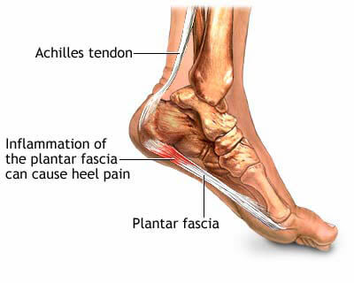 Heel Pain Shoes