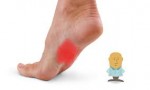 Plantar Fasciitis,Pes Planus,Mallet Toe,High Arched Feet,Heel Spur,Heel Pain,Hammer Toe,Hallux Valgus,Foot Pain,Foot Hard Skin,Foot Conditions,Foot Callous,Flat Feet,Fallen Arches,Diabetic Foot,Contracted Toe,Claw Toe,Bunions Hard Skin,Bunions Callous,Bunion Pain,Ball Of Foot Pain,Back Pain