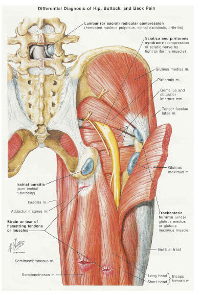 Here's How Long It Takes To Get Rid of Piriformis Syndrome - Coach