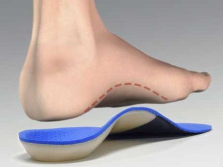 custom orthotics to fix capsulitis