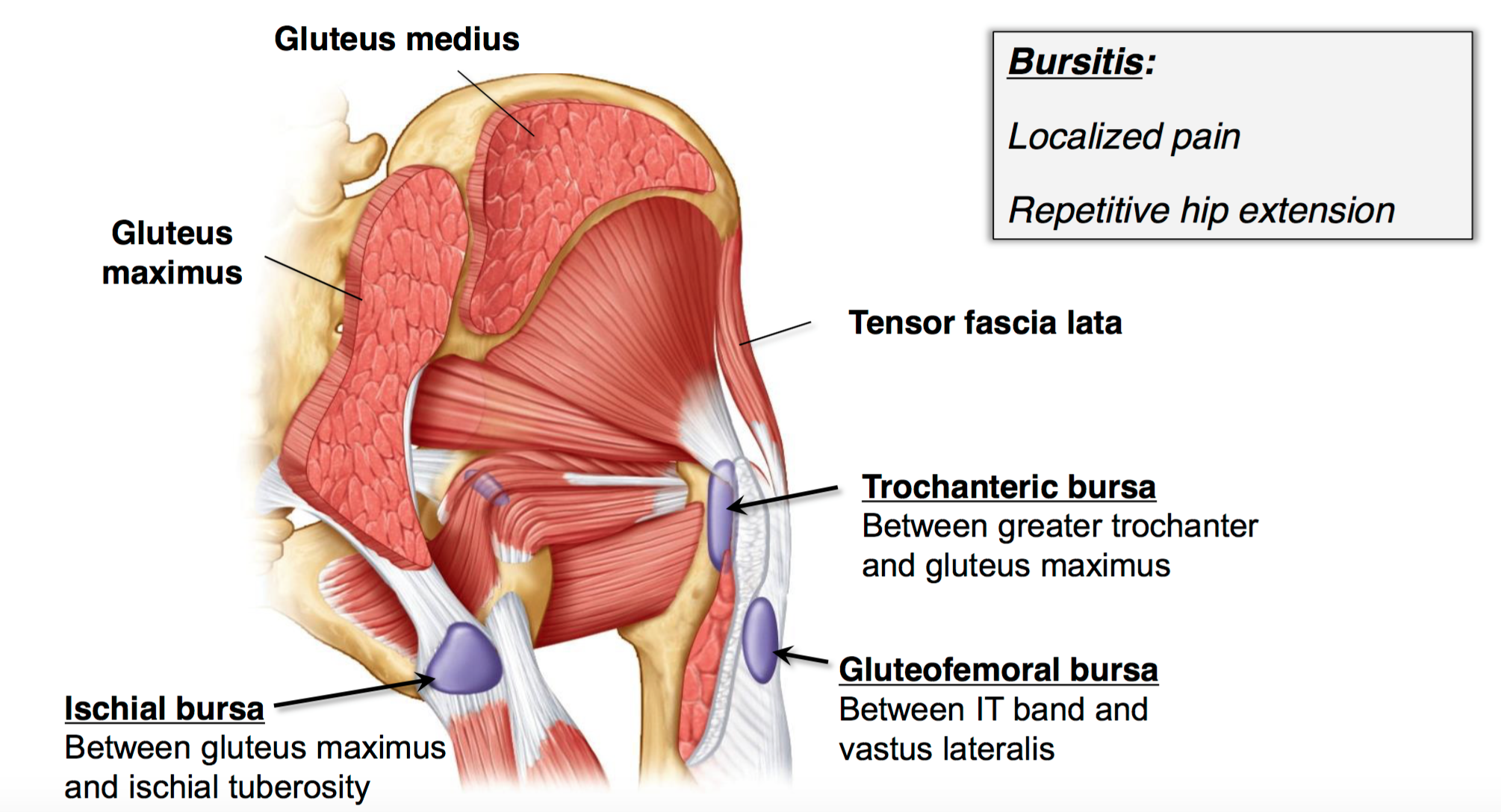 Ischial Bursitis  Rehab My Patient