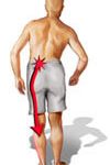 Disc pain or Sciatica shoots down the leg on the involved side