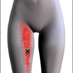 Groin pain can be an adductor strain/tear but sports hernia should be considered