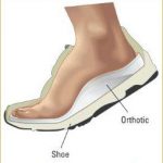 shoes and the right orthotic can work in synergy