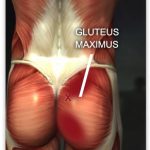 unfortunately strengthening glutes will not correct a leg length inequality