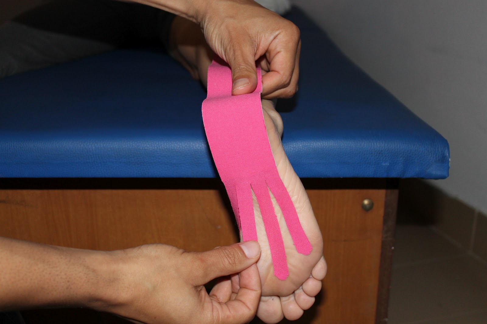 taping for calcaneal spur