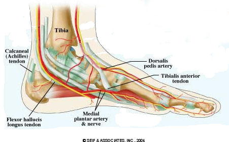Causes Heel Pain due to an entrapped nerve