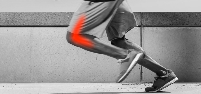 How do I fix Iliotibial Band Syndrome - San Diego Running & Sports ...