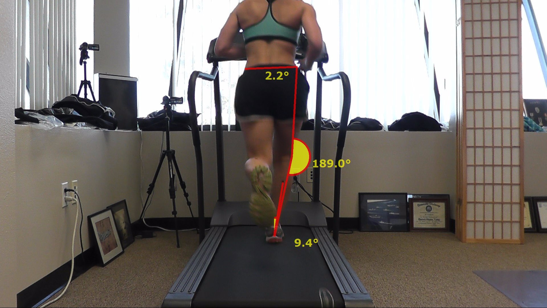 Computerized gait analysis can help prevent injury and improve form