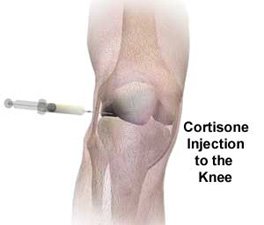 Cortisone is not usually recommended to fix Iliotibial Band Syndrome